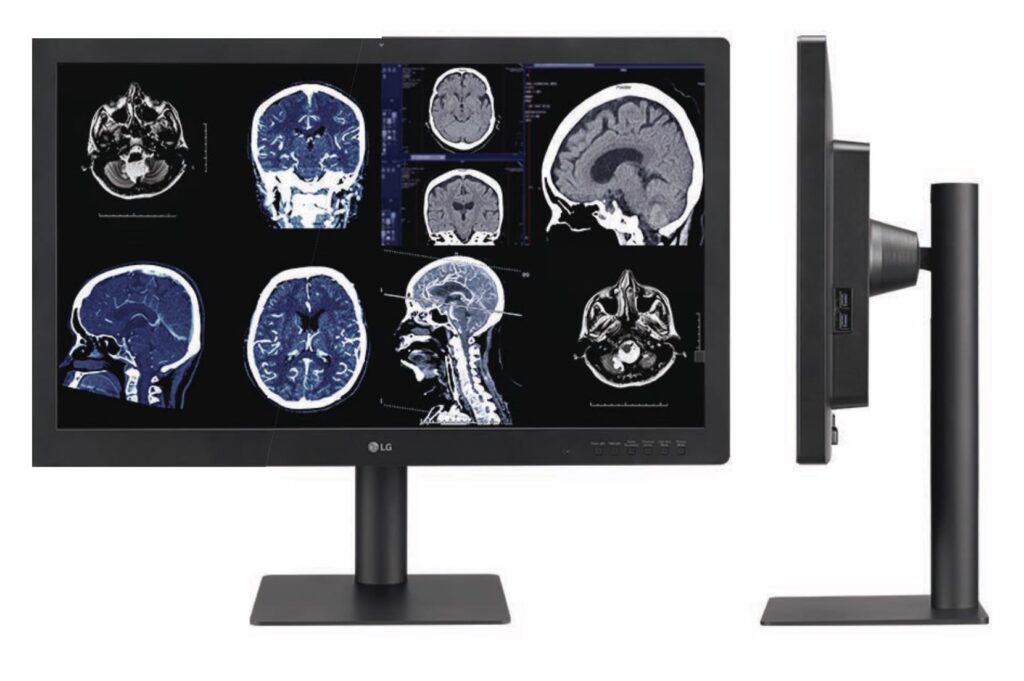 LG Diagnostics Monitor